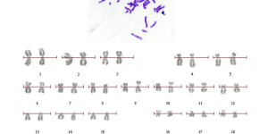 Кариотип — ваш генетический портрет