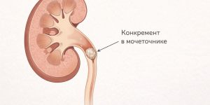 Прием врача уролога в МедЛаб Жемчужина