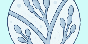 Грибковая инфекция — как не пропустить?