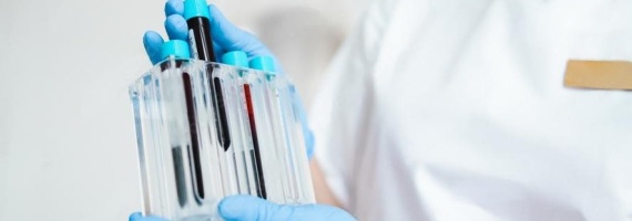 Плазмолифтинг со скидкой