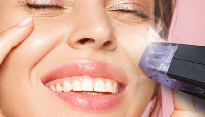 Фотоомоложение Lumecca