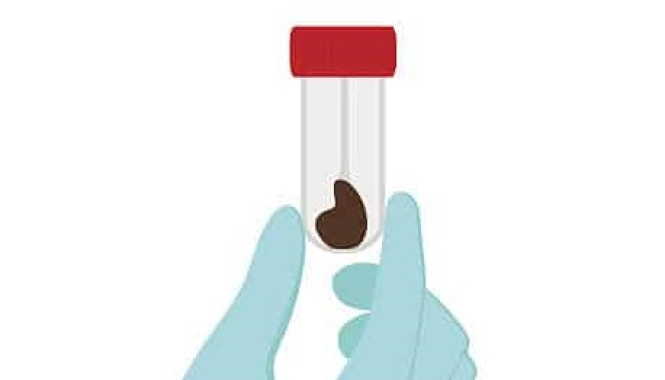 Анализы кала