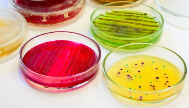 Бак. посевы