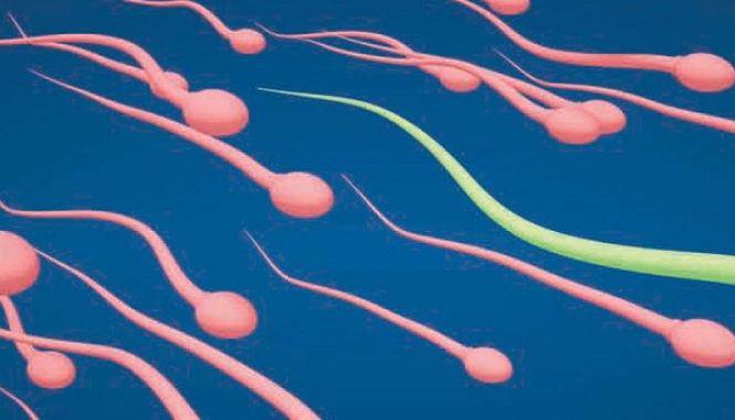 Анализы спермы