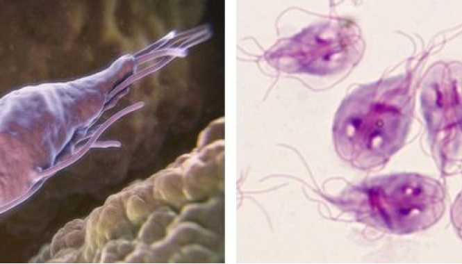 Лямблиоз и «подводные камни» его диагностики