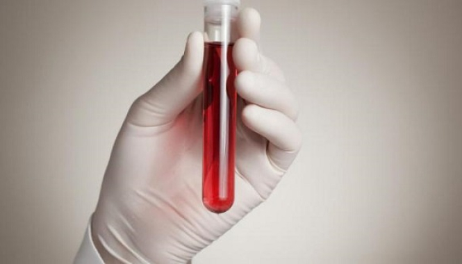 Тромбофилия (Генетическая предрасположенность)