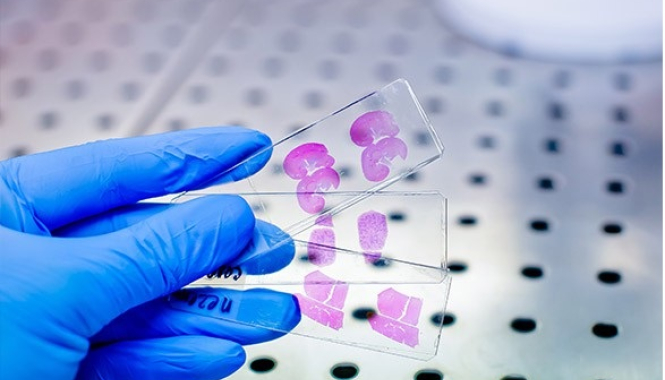 Биопсия шейки матки