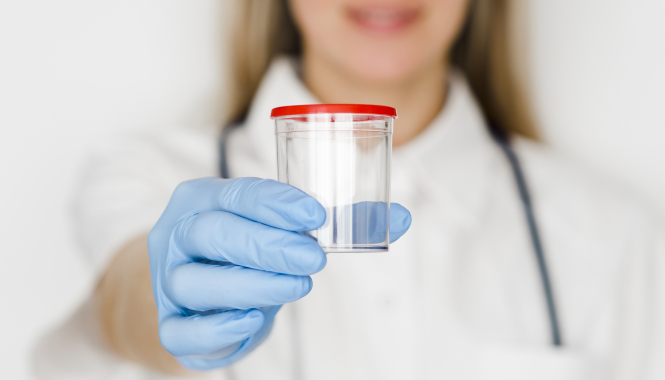 Фекальный кальпротектин