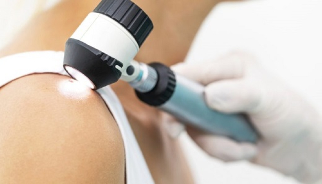 Удаление новообразований