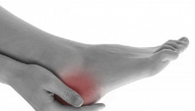 Подпяточный бурсит