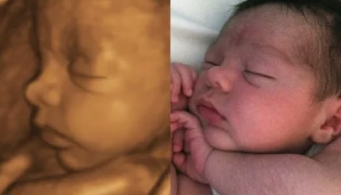 3D/4D-скрининг на Богатырском