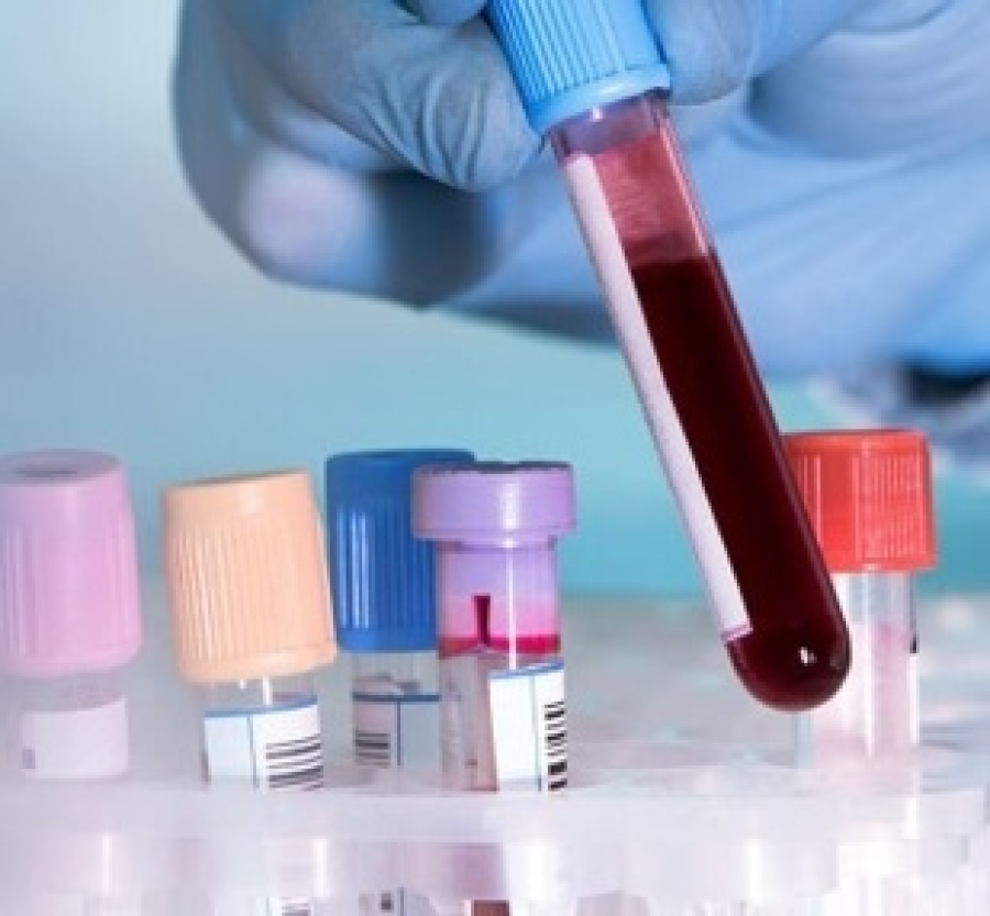 Анализ крови