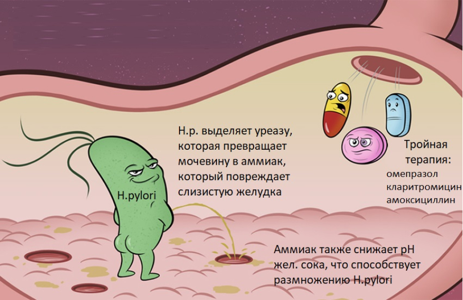 Хеликобактер пилори и желудок