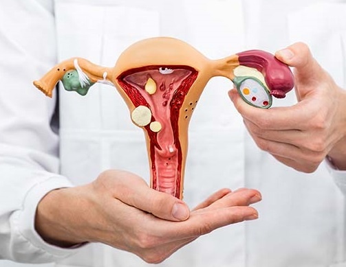 Preparation for ultrasound of the pelvic organs (uterus, appendages) in women