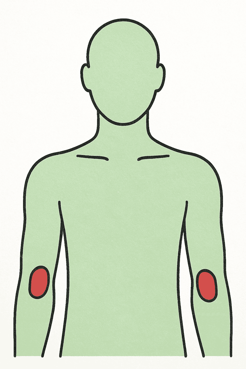 УЗИ локтевых суставов