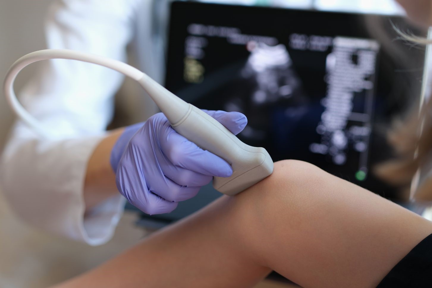 УЗИ суставов